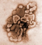 H1N1 Influenza Virus