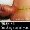 FDA & HHS Anti-Tobacco Warning - 07